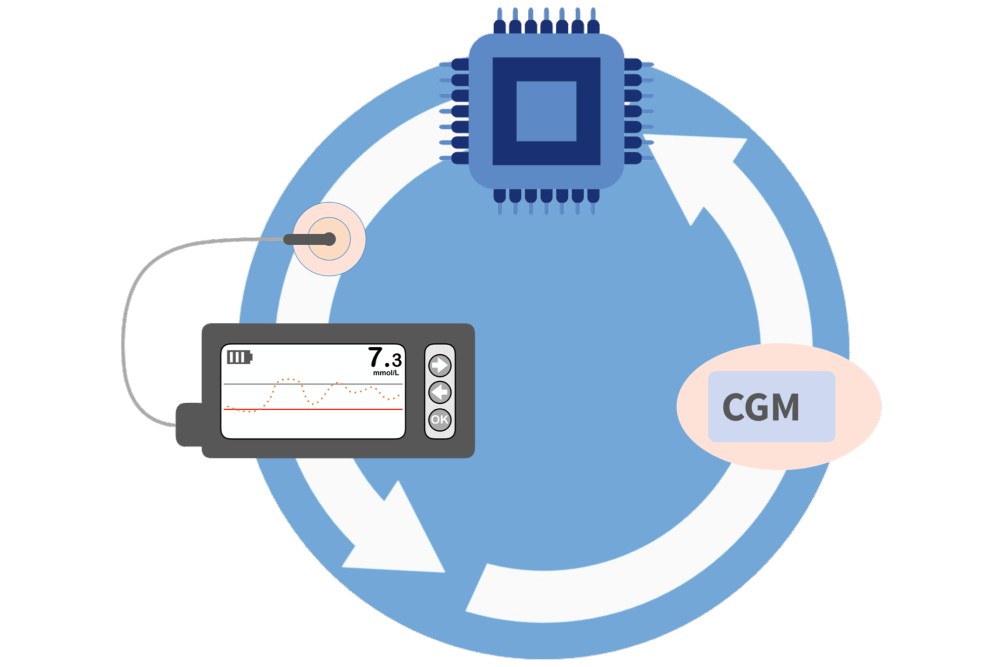 Sensor Augmented Pumps (SAP)