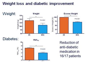 EndoBarrier Weight Loss and Glycaemic Control Image